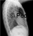 Chest Pain in the Emergency Department