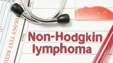 Non-hodgkin's Lymphoma