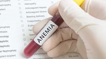 Anemia