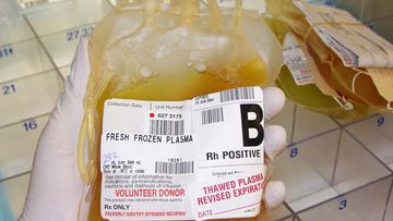 Platelet Transfusion