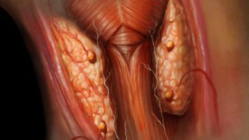 Primary Hyperparathyroidism - Blood Picture