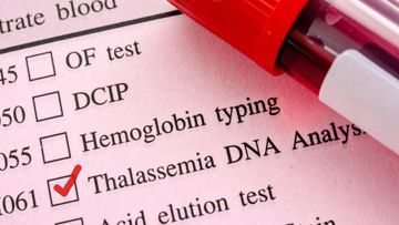 Thalassemia Management