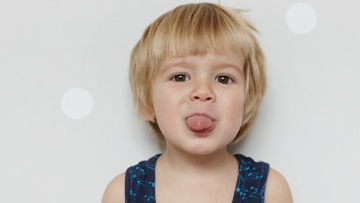 Tongue Tie in Infants