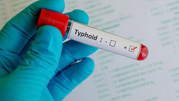 Typhoid Vaccine