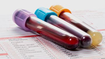 Blood Testing - CBC